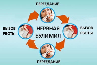Лечение булимии в Кудымкаре